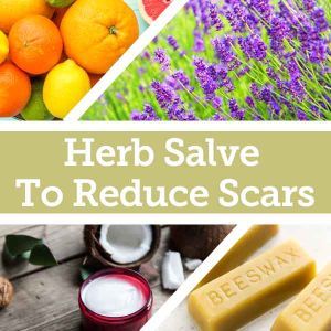 Baldwins Remedy Creator - Herbal Salve To Reduce Scars